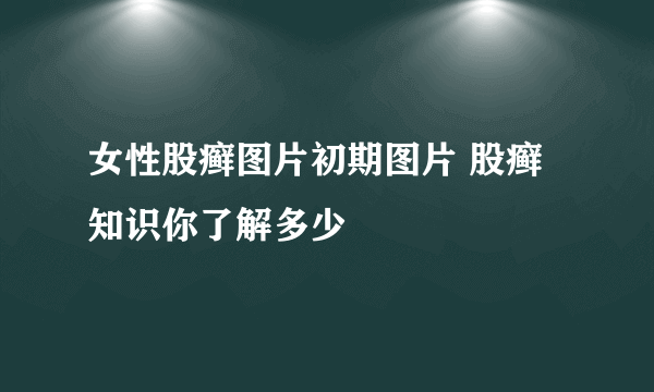 女性股癣图片初期图片 股癣知识你了解多少