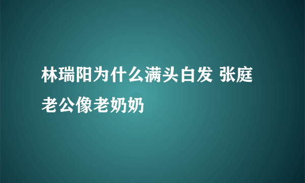 林瑞阳为什么满头白发 张庭老公像老奶奶