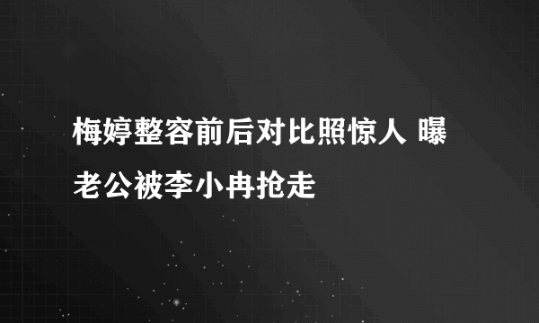 梅婷整容前后对比照惊人 曝老公被李小冉抢走