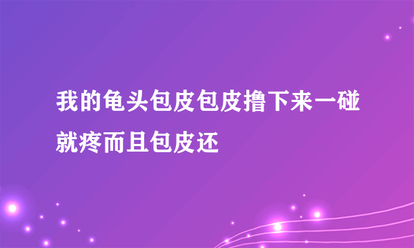 我的龟头包皮包皮撸下来一碰就疼而且包皮还