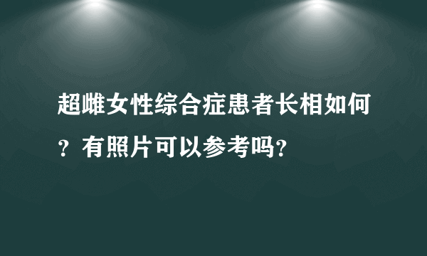 超雌女性综合症患者长相如何？有照片可以参考吗？