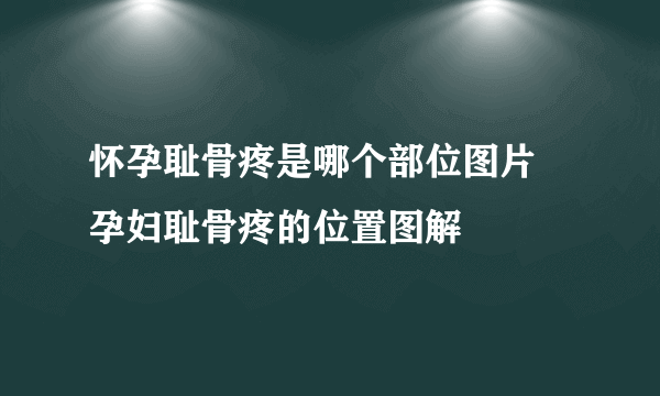 怀孕耻骨疼是哪个部位图片 孕妇耻骨疼的位置图解