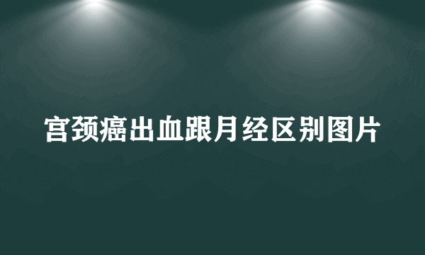 宫颈癌出血跟月经区别图片