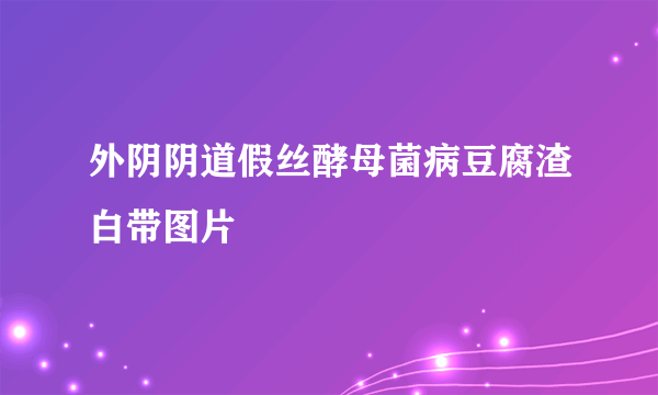 外阴阴道假丝酵母菌病豆腐渣白带图片