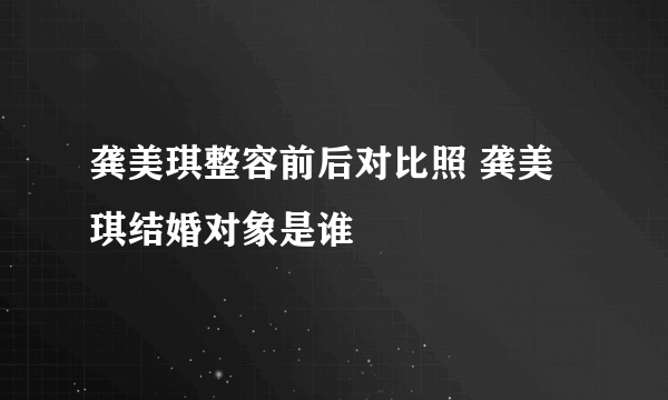 龚美琪整容前后对比照 龚美琪结婚对象是谁