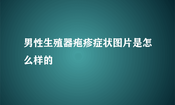 男性生殖器疱疹症状图片是怎么样的