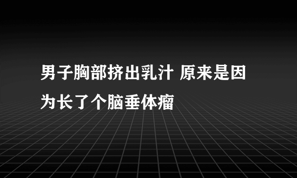 男子胸部挤出乳汁 原来是因为长了个脑垂体瘤