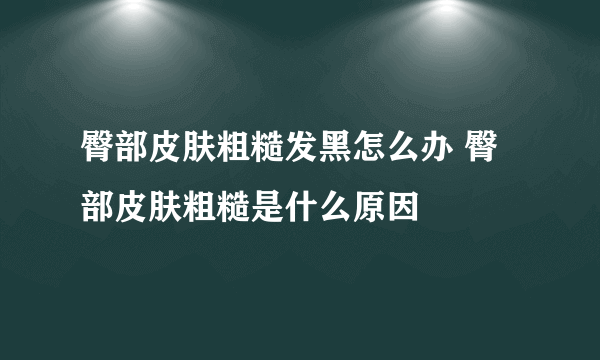 臀部皮肤粗糙发黑怎么办 臀部皮肤粗糙是什么原因