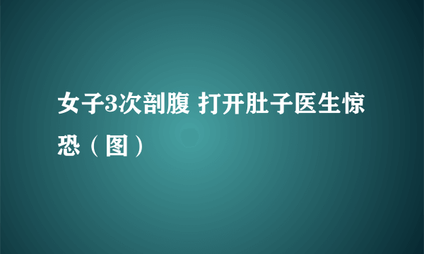 女子3次剖腹 打开肚子医生惊恐（图）