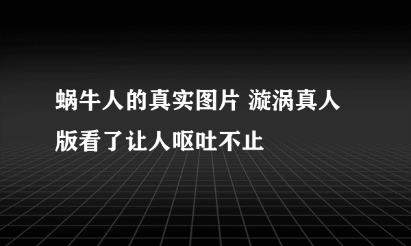 蜗牛人的真实图片 漩涡真人版看了让人呕吐不止