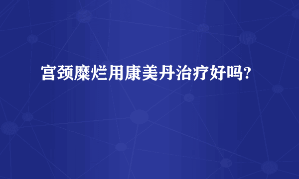 宫颈糜烂用康美丹治疗好吗?