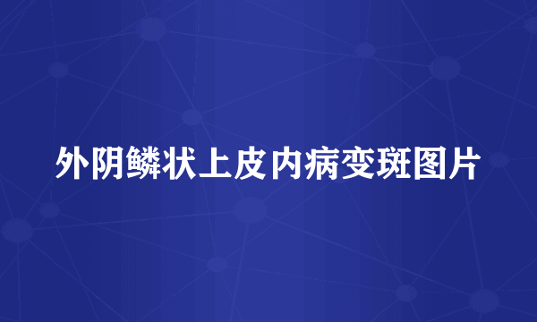 外阴鳞状上皮内病变斑图片