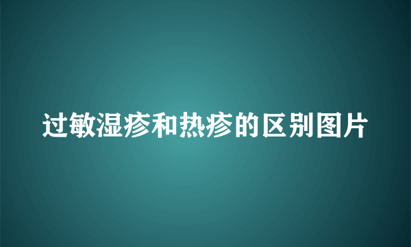 过敏湿疹和热疹的区别图片