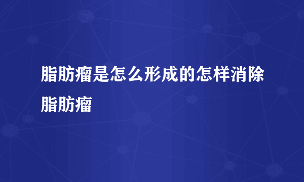 脂肪瘤是怎么形成的怎样消除脂肪瘤