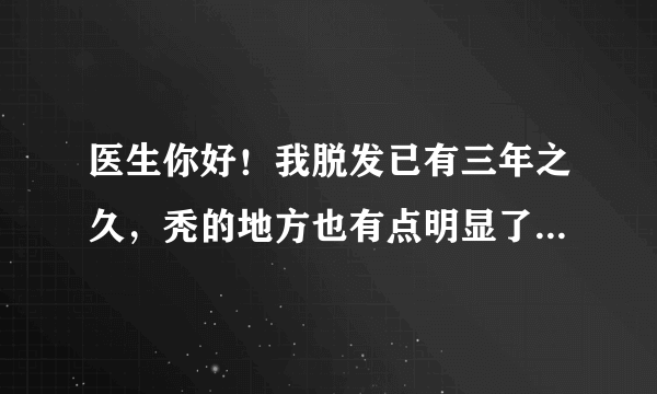 医生你好！我脱发已有三年之久，秃的地方也有点明显了。最近在电视上看到：霍氏生发宝的疗效！你说有效果