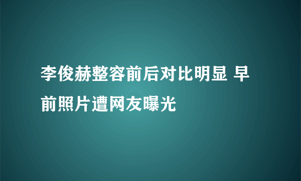 李俊赫整容前后对比明显 早前照片遭网友曝光