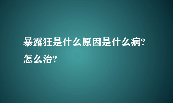 暴露狂是什么原因是什么病?怎么治?