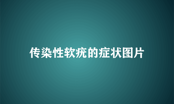 传染性软疣的症状图片