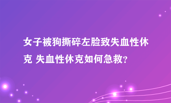 女子被狗撕碎左脸致失血性休克 失血性休克如何急救？