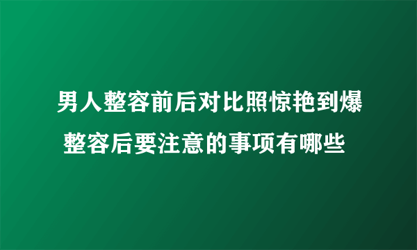 男人整容前后对比照惊艳到爆 整容后要注意的事项有哪些