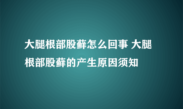 大腿根部股藓怎么回事 大腿根部股藓的产生原因须知