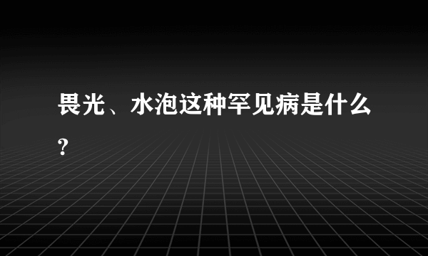 畏光、水泡这种罕见病是什么?