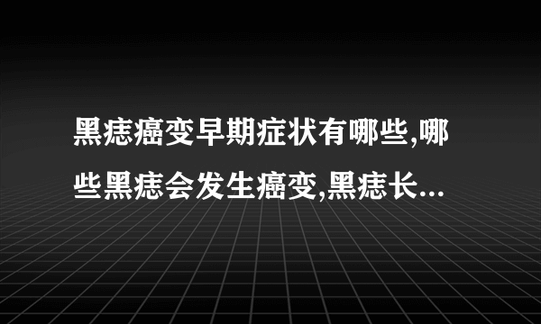 黑痣癌变早期症状有哪些,哪些黑痣会发生癌变,黑痣长在什么部位容易癌变,黑痣癌有哪些种类