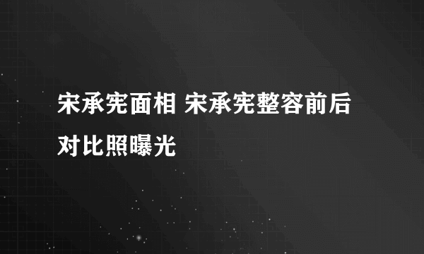 宋承宪面相 宋承宪整容前后对比照曝光