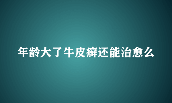 年龄大了牛皮癣还能治愈么