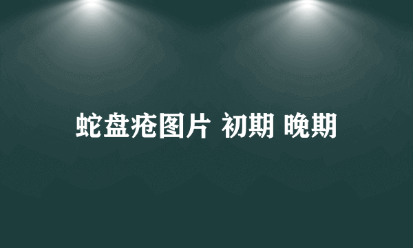 蛇盘疮图片 初期 晚期