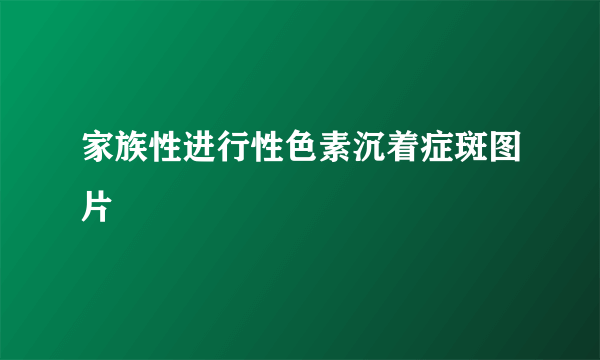 家族性进行性色素沉着症斑图片