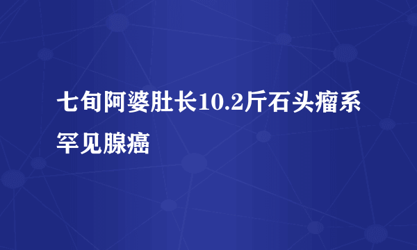 七旬阿婆肚长10.2斤石头瘤系罕见腺癌