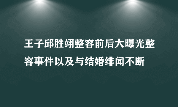 王子邱胜翊整容前后大曝光整容事件以及与结婚绯闻不断