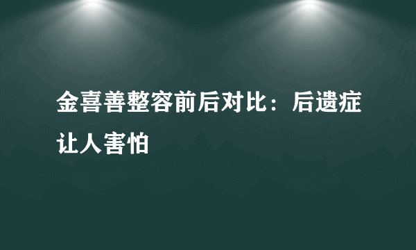 金喜善整容前后对比：后遗症让人害怕