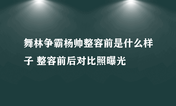 舞林争霸杨帅整容前是什么样子 整容前后对比照曝光