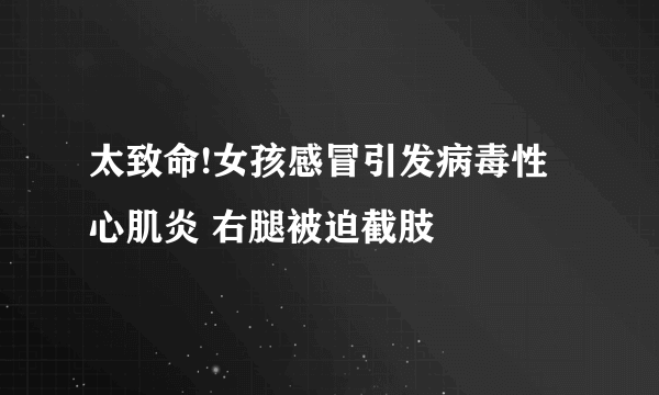 太致命!女孩感冒引发病毒性心肌炎 右腿被迫截肢