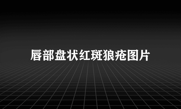 唇部盘状红斑狼疮图片