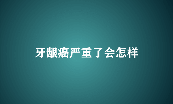 牙龈癌严重了会怎样