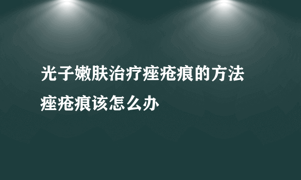 光子嫩肤治疗痤疮痕的方法 痤疮痕该怎么办