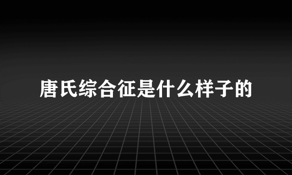 唐氏综合征是什么样子的