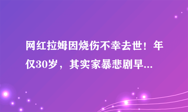 网红拉姆因烧伤不幸去世！年仅30岁，其实家暴悲剧早就有迹可循