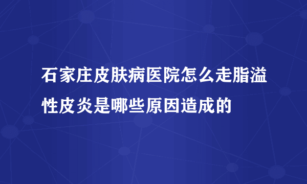 石家庄皮肤病医院怎么走脂溢性皮炎是哪些原因造成的