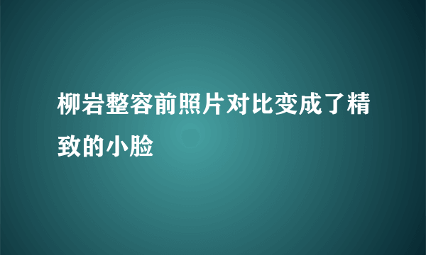 柳岩整容前照片对比变成了精致的小脸