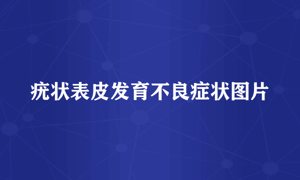 疣状表皮发育不良症状图片