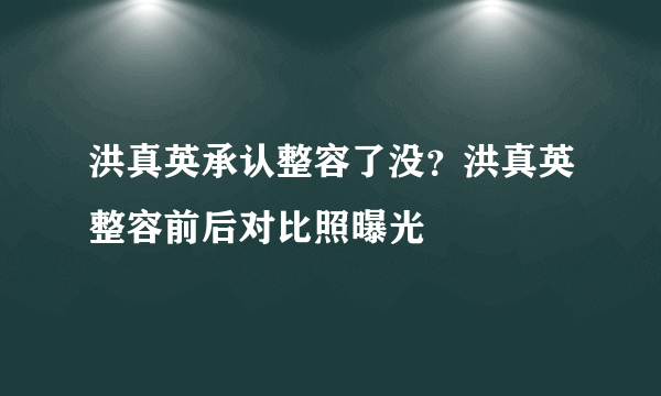 洪真英承认整容了没？洪真英整容前后对比照曝光