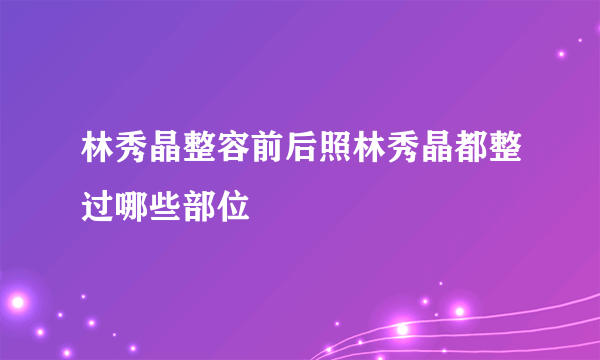 林秀晶整容前后照林秀晶都整过哪些部位