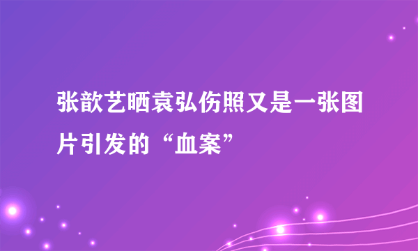 张歆艺晒袁弘伤照又是一张图片引发的“血案”