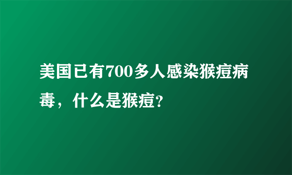 美国已有700多人感染猴痘病毒，什么是猴痘？