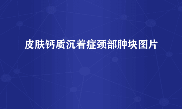 皮肤钙质沉着症颈部肿块图片