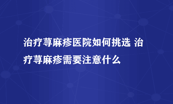 治疗荨麻疹医院如何挑选 治疗荨麻疹需要注意什么